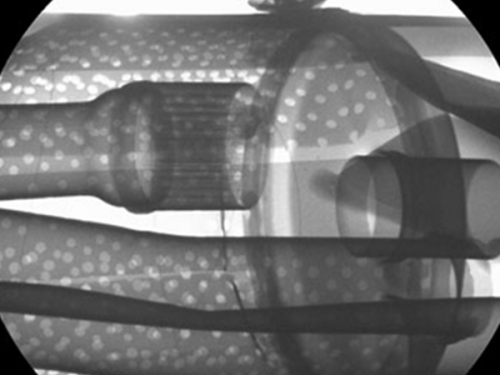 金属结构油、水管道X射线检测图像